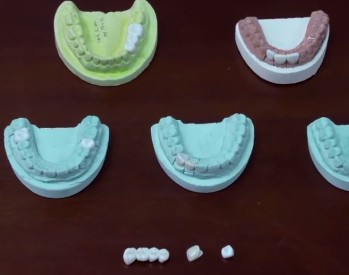 分享最前沿數字化齒科技術  金石三維與您相約2020亞太口腔展