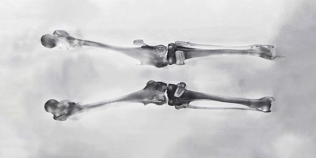 醫療器械 醫療器械